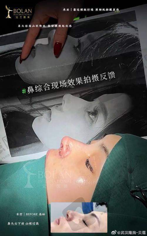 大连高岚医疗美容门诊部特色项目及技术优势