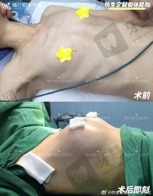 上海鹏爱医疗美容医院真人口碑评价怎么样?