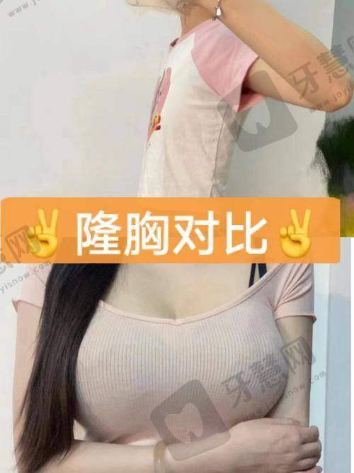 上海同济大学附属天佑医院医疗美容科是正规医院吗？