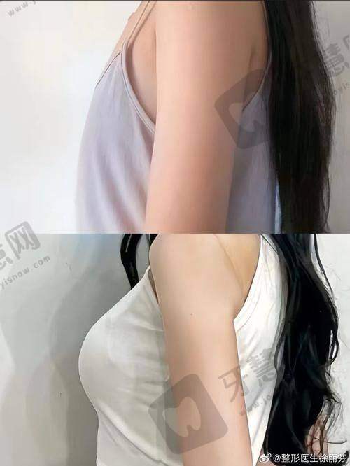 上海同济大学附属天佑医院医疗美容科特色项目及技术优势