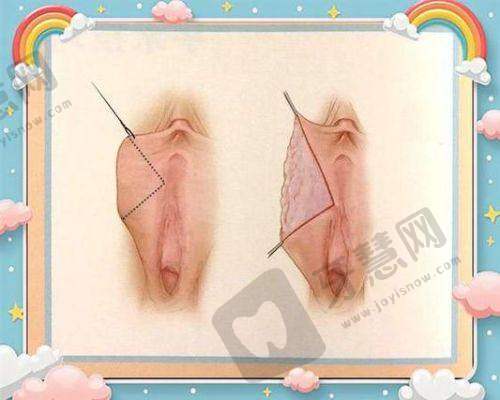 郑州爱美眼医疗美容诊所是正规医院吗?