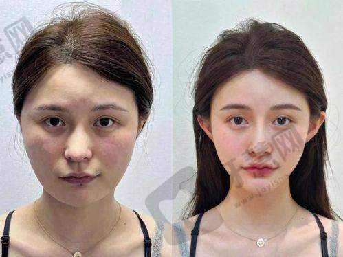 上海鹏爱医疗美容医院详细的预约挂号方式及流程