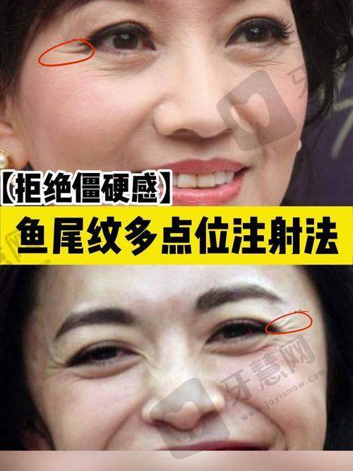 张金娥医生擅长的眼部整形项目