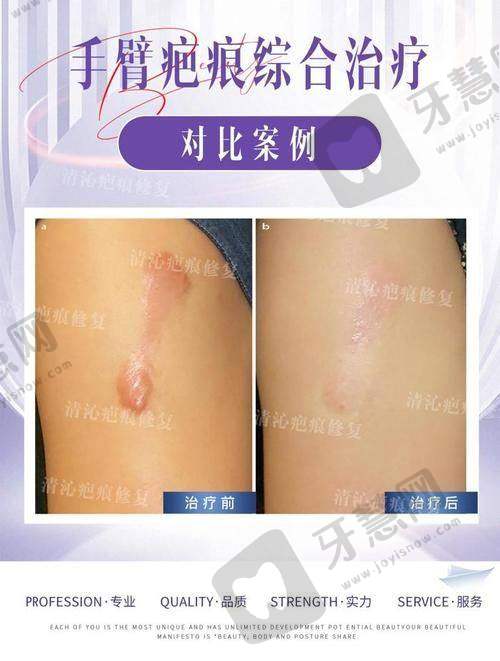 庄洪兴医生的擅长项目