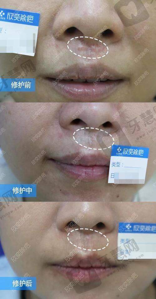 庄洪兴医生的口碑评价及反馈内容