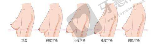 贵阳妍僖医疗美容医院植发科口碑如何?