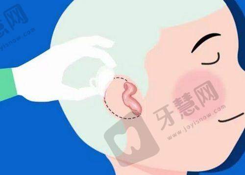 沈阳元辰整形医院口碑如何