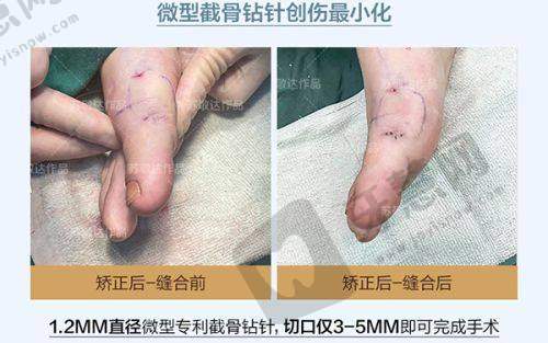 魏志香医生——2025修复双眼皮的实力担当