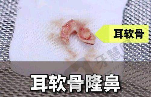 宝鸡韩美整形美容医院——眼部整形特色与价格