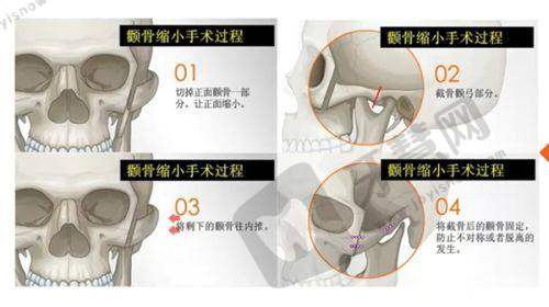北京叶子医疗美容医院地址及乘车路线
