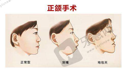 东莞壹加壹整形医院预约挂号