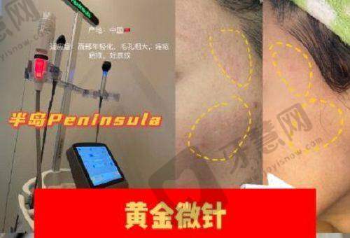 宝鸡亿美医疗美容医院——眼部修复的专精之选