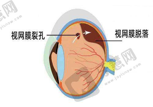 西安市第一医院眼科