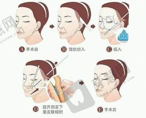长沙碧莲盛植发医院地址电话及营业时间: