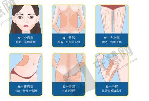 贵阳星妍芭莎美容医院植发科正规吗?