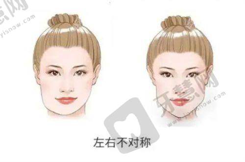 贵阳妍僖医疗美容医院植发科收费价格表：