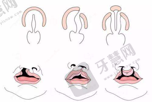 沈阳元辰整形医院诊疗项目