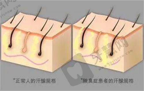 贵阳碧莲盛植发收费价格表：