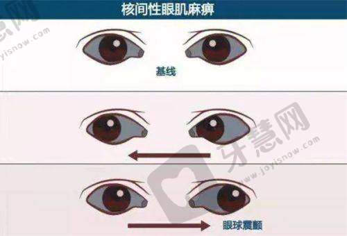 爱尔眼科医院集团