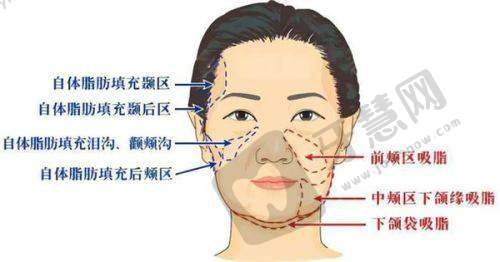 包头地区疤痕修复医院的多样方法与价格