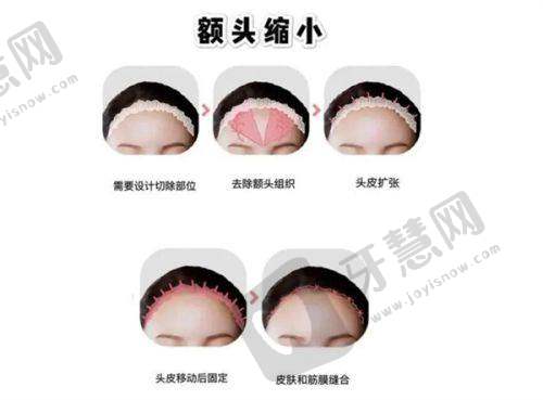 王志军整形外科医师去哪里了，北京美吉拉/联合丽格二院坐诊擅长拉皮