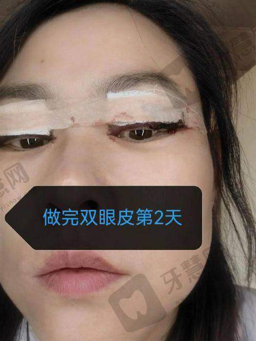 闵英俊医生的顾客好评内容