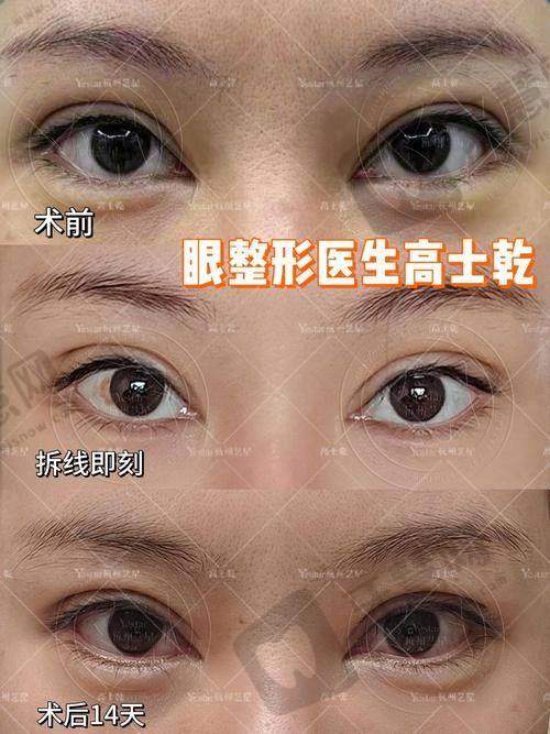 太原时光整形美容医院口碑如何