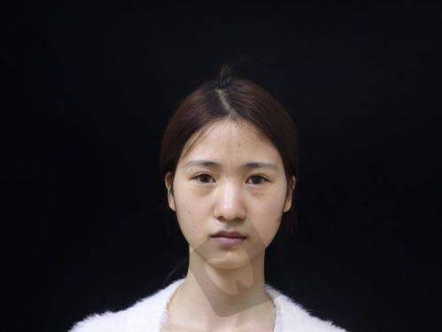 东莞壹加壹整形医院诊疗项目