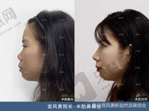 师俊莉医生的技术优势亮点
