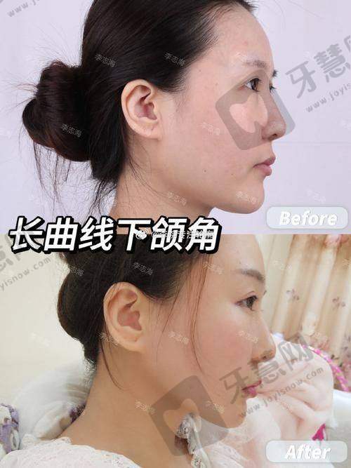 何照华医生的口碑评价及反馈内容