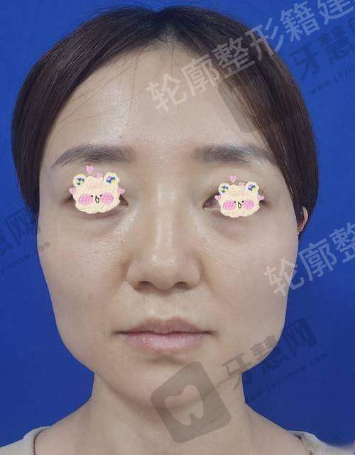何照华医生的擅长项目解析