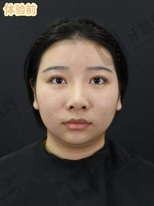 沈阳七悦一美整形医院正规吗?