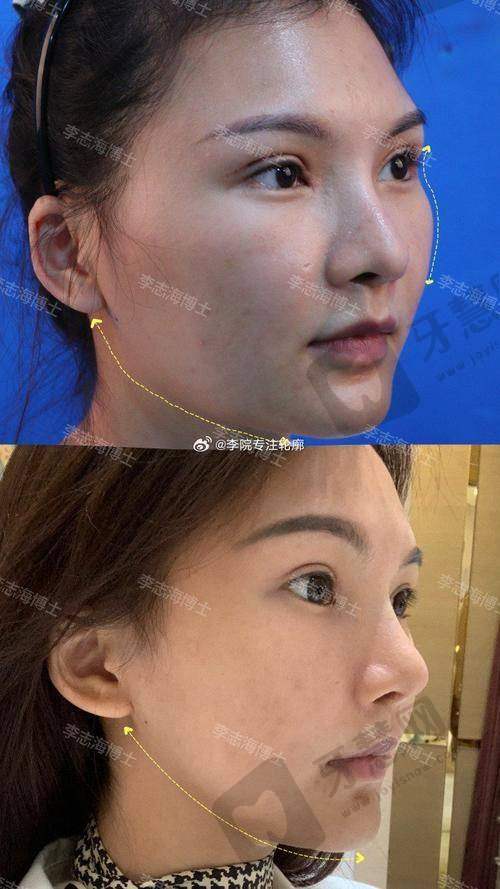 何照华医生的顾客好评分享