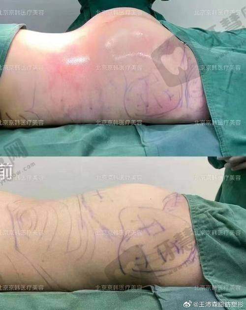 沈阳元辰整形医院地址电话