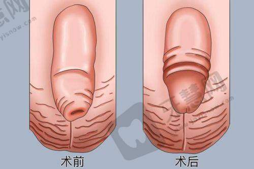 东莞美立方医美医院预约挂号