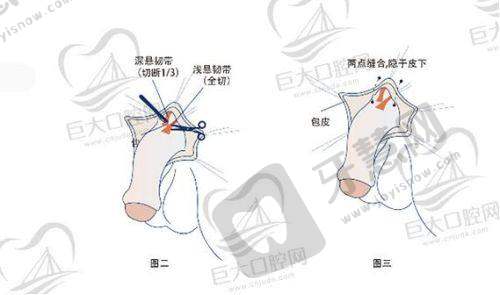 北京三仁医疗美容门诊部口碑好不好?附真实患者口碑评价