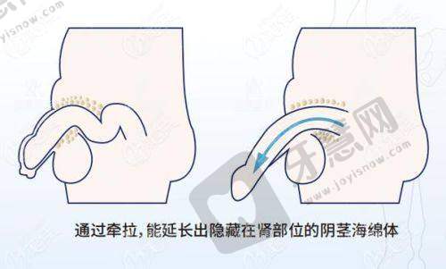北京伊芙丽格医疗美容诊所口碑好不好?附真实患者口碑评价