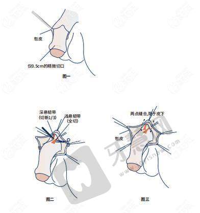 北京蕾士悦容整形医院价格表