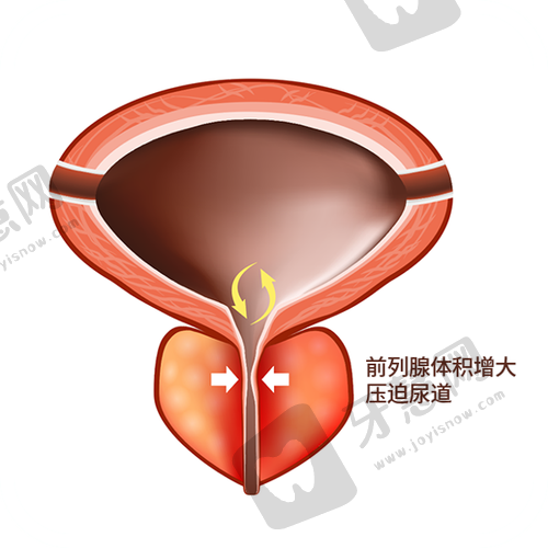 注射美容动态平衡技术