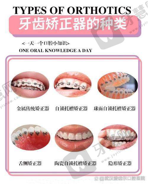 济宁壹颗芽口腔门诊部(汽车南站店)真人口碑评价怎么样?
