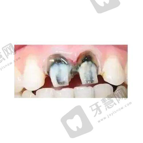 济宁壹颗芽口腔门诊部(汽车南站店)详细的预约挂号方式及流程