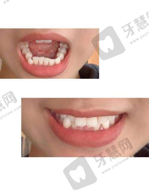 上海宝泽莉口腔门诊部是正规医院吗?