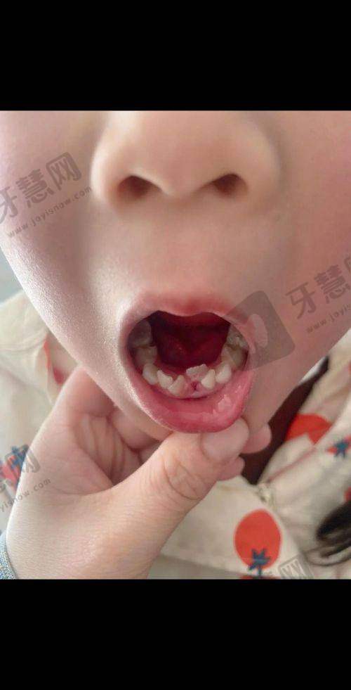 西安英卓口腔门诊部（高新店）是正规医院吗？