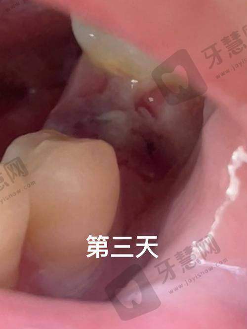 西安晶品口腔门诊部详细的预约挂号方式及流程