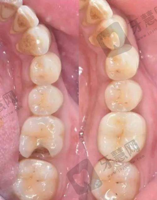 西安晶品口腔门诊部是正规医院吗?