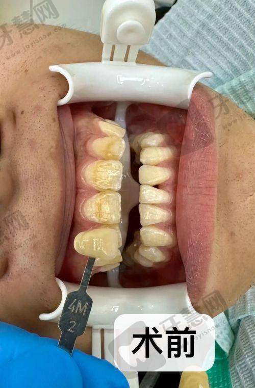 西安未央爱康口腔门诊部真人口碑评价怎么样？