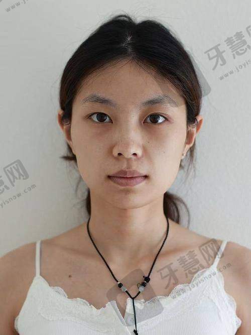 杨明强医生的个人资料与成就
