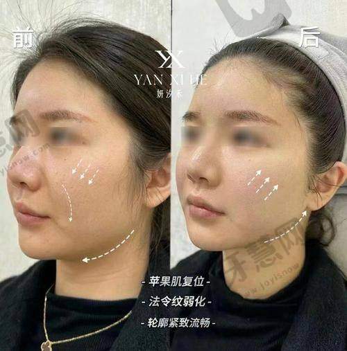 王莉医生的口碑评价及反馈内容
