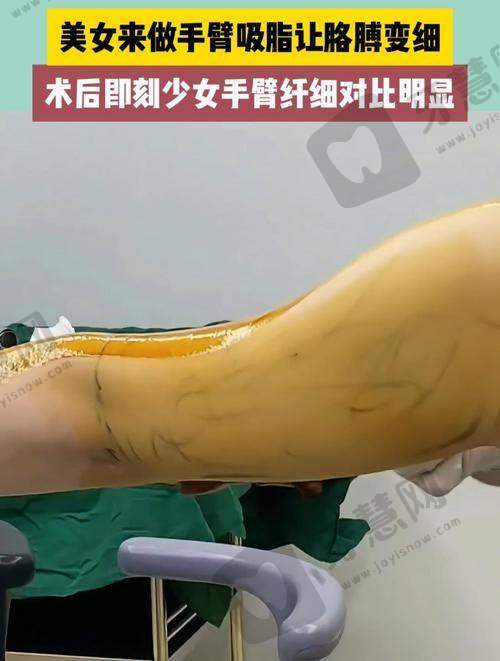 辽宁曙光（原协和）整形医院医生介绍