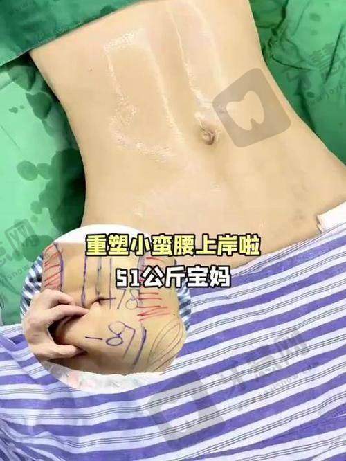 薛凯文医生擅长的整形项目